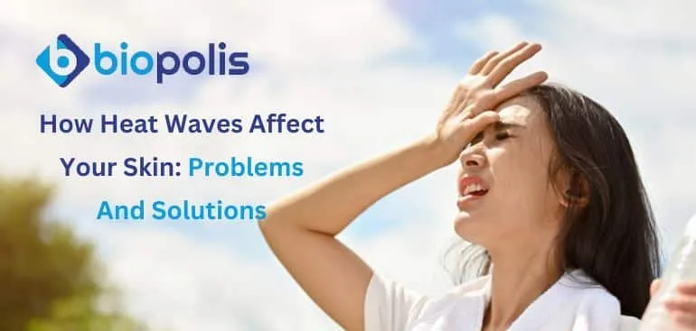 How Heat Waves Affect Your Skin Problems and Solutions