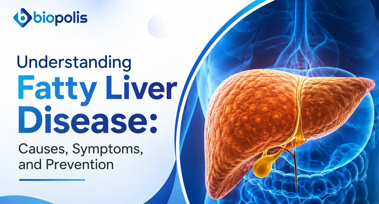 Fatty Liver Disease Causes, Symptoms & Prevention
